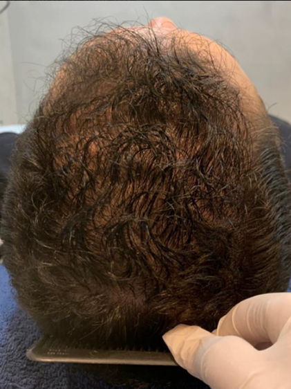 Adhones Clínica - Estética Masculina e Saúde