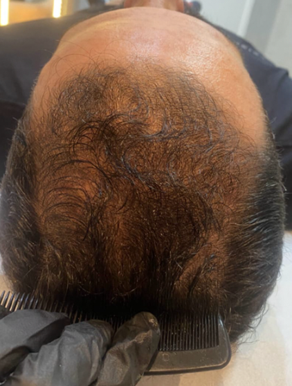 Adhones Clínica – Estética Masculina e Saúde Adhones Clínica - Estética Masculina e Saúde